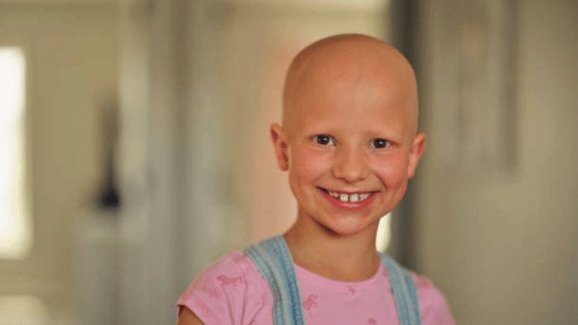 Alopecia because of chemotherapy 
