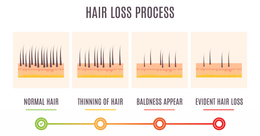 Signs of hair loss